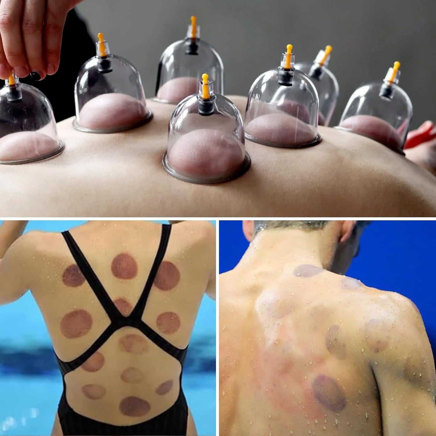 Cupping Kit for Massage Therapy - 32 Cups Professional Chinese Cupping Set with Magnetics, Vacuum Cupping Therapy Set for Cellulite Reduction Muscle Pain Relief with Manual Pump