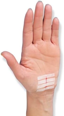 Nexcare Steri-Strip Wound Closure, Breathable Strips Hold Small Wounds Firmly Closed, Great After Sutures or Staples - 30 Wound Closures