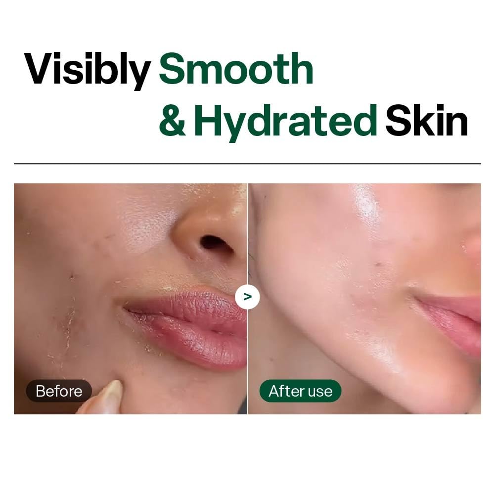 Dr. G Brightening Peeling Gel - Korean Skincare for Glowy Skin - Aqua Gommage Facial Exfoliator - Hyaluronic Acid, Ceramides, Vitamin C - Smooth Skin Texture, Low Irritation - Bulk Items - 4.23 fl oz