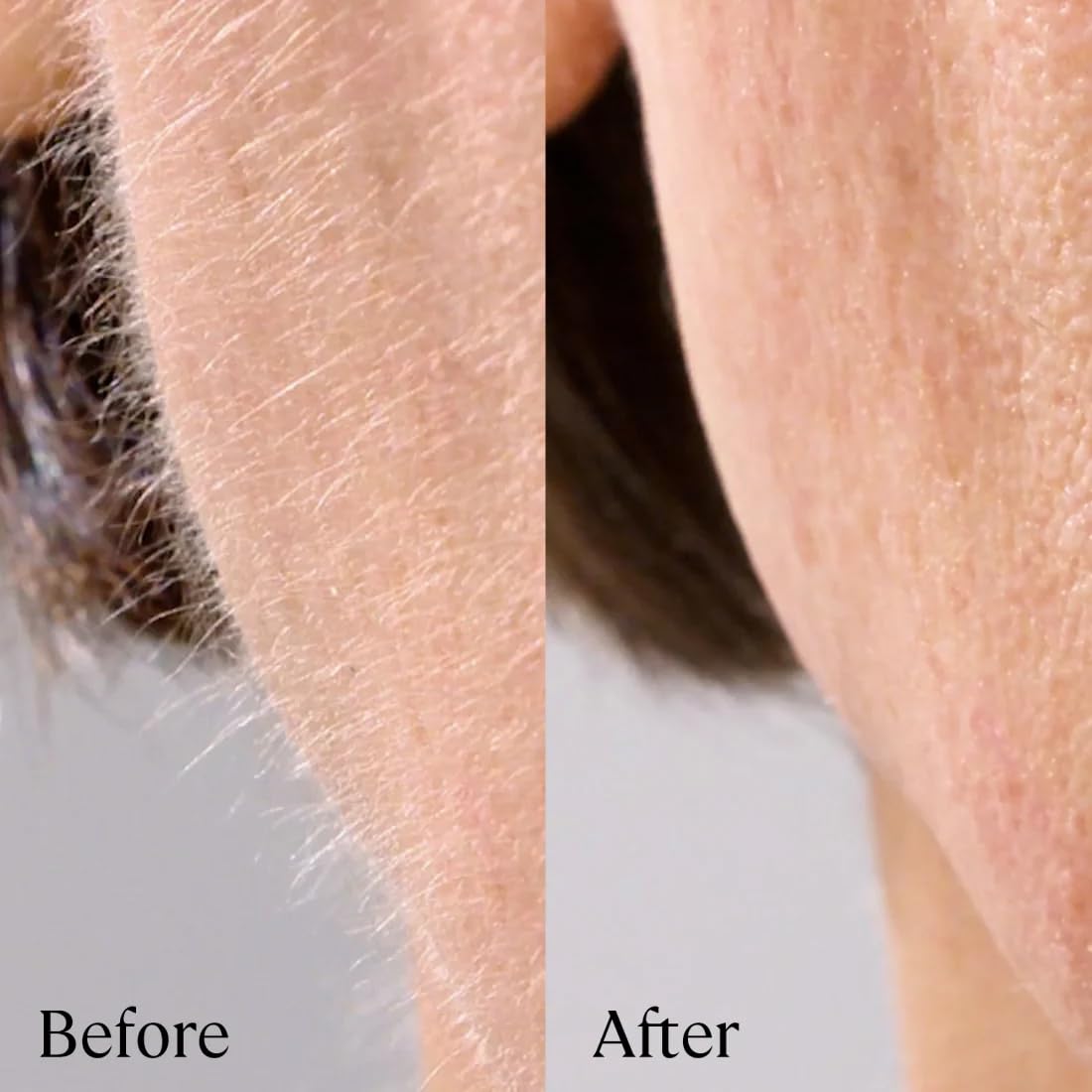 Michael Todd Beauty Sonicsmooth Pro+ Dermaplane Razor Blade Refills - 8 Dermaplaning Blades - 2 Month Supply - Device Not Included