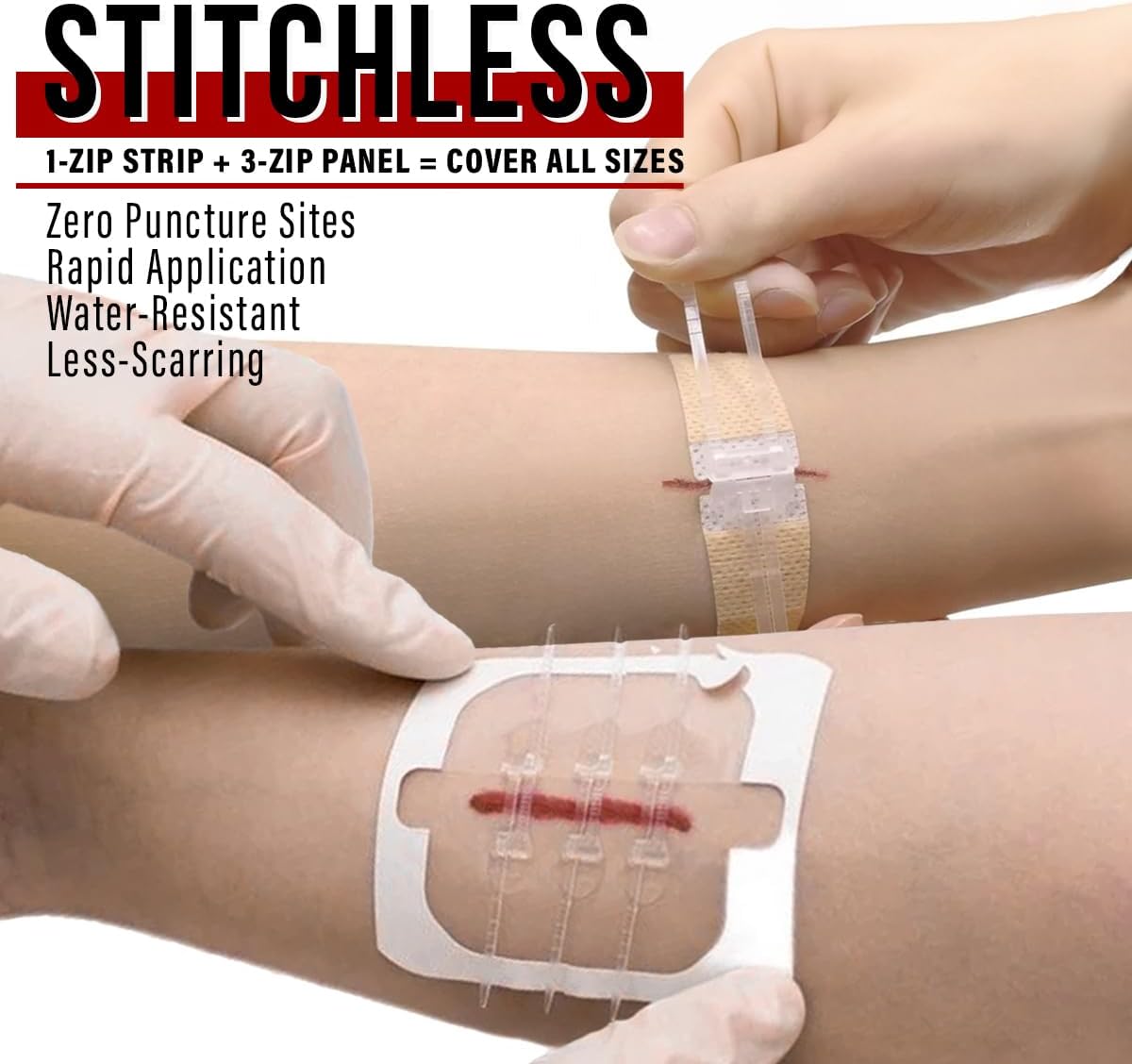 EVERLIT Wound Closure Pack | 4 Pcs Surgical Wound Zip Devices for Cut & Laceration Wound Repair | Sterile, Suture-Free, Stitch-Less Adhesive Butterfly Bandage Strips for Emergency First Aid Care