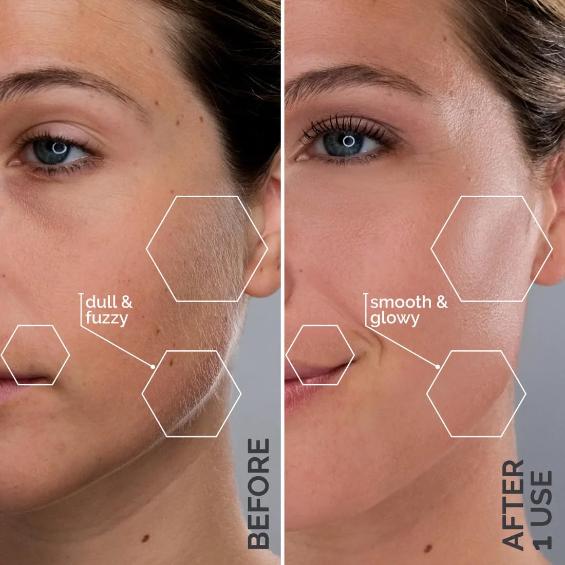 Michael Todd Beauty Sonicsmooth Pro+ Dermaplane Razor Blade Refills - 8 Dermaplaning Blades - 2 Month Supply - Device Not Included