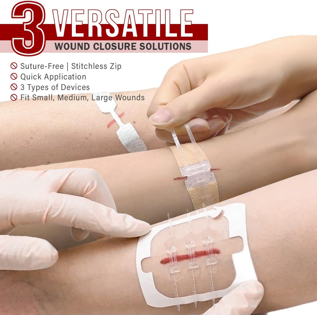 Wound Closure Kit | 28 Pcs All-in-One First Aid with Suture-Free, Stitchless Zip Devices, Butterfly Bandages, for up to 6" Wounds | 100% Sterile Medical Supplies to Clean, Cover & Heal