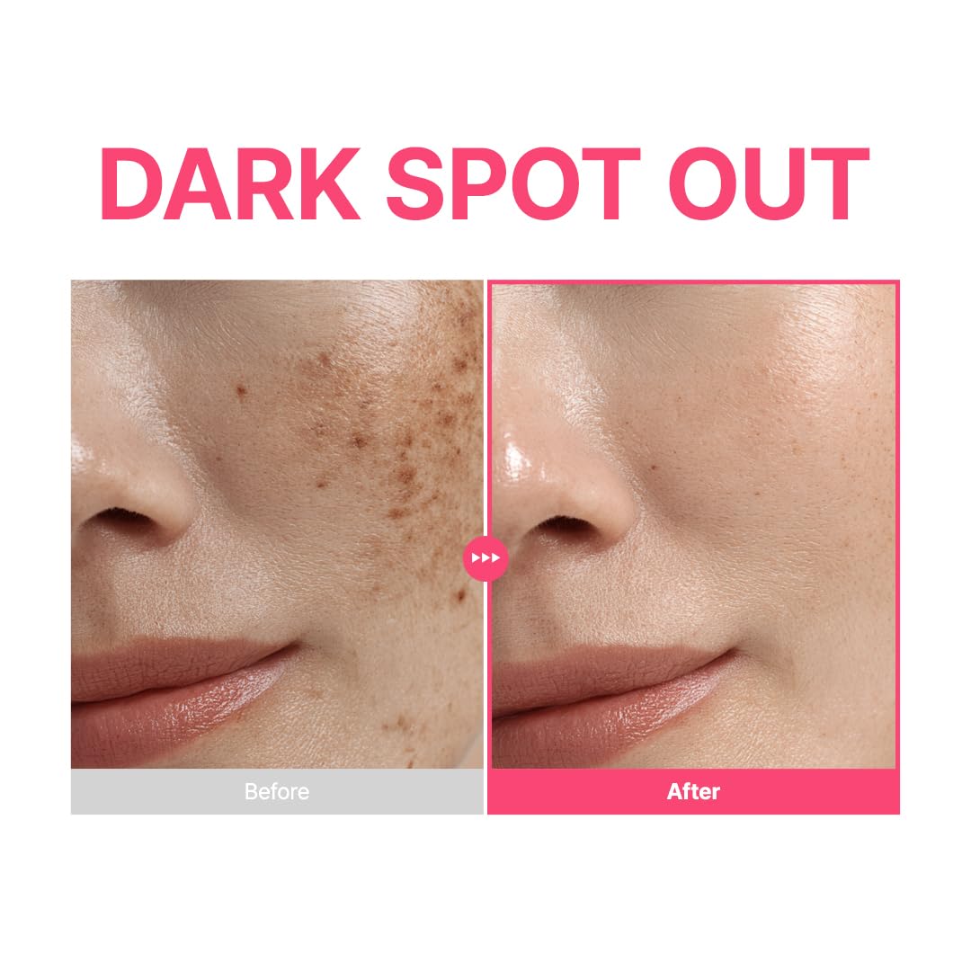 PURITO TXA 6% + Niacinamide 10% + Retinal Facial Serum | for Dark Spots, Hyperpigmentation, Uneven Tone | High-Level Tranexamic Acid 6% | Korean skincare, 30mL 1.01 fl.oz