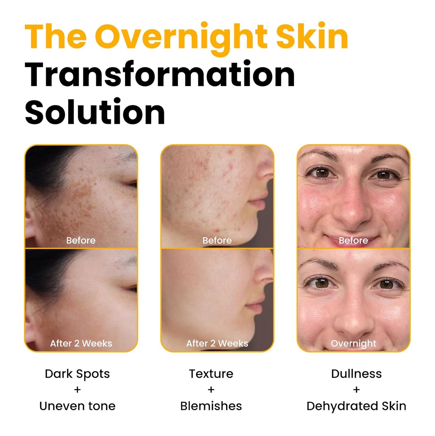 QUIA Turmeric + Kojic Acid Overnight Wrapping Mask – Hydration Mask for Glowing Skin – Evens Tone, Soothes Redness and Improves Skin Texture – Korean Skincare 75ML