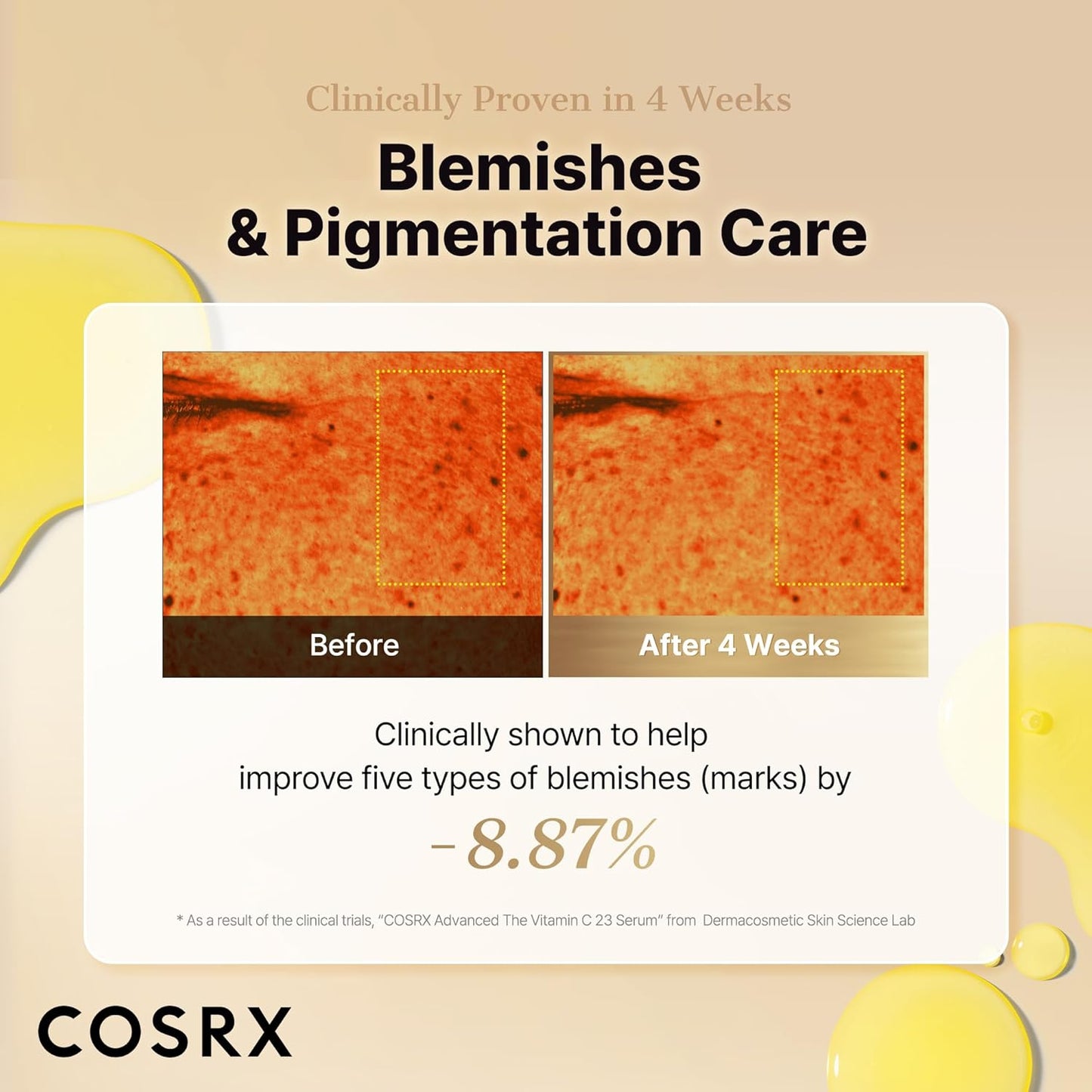 COSRX Advanced Pure Vitamin C 23% Serum with Vitamin E & Glutathione (Renewal), Korean Vitamin C Serum for Fine Lines, Uneven Skin Tone & Dull Skin, 0.7oz, Korean Skin Care