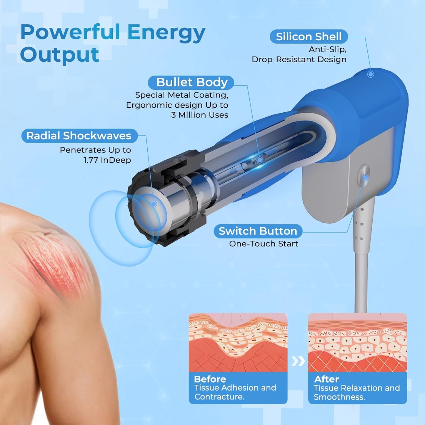 2026 New Upgraded Shockwave Therapy Machine, Extracorporeal Shock Wave Therapy Device for Pain Relief,Muscle and Bone Tissue Regeneration, ESWT Shock Wave Therapy Machine for Home & Institution Use