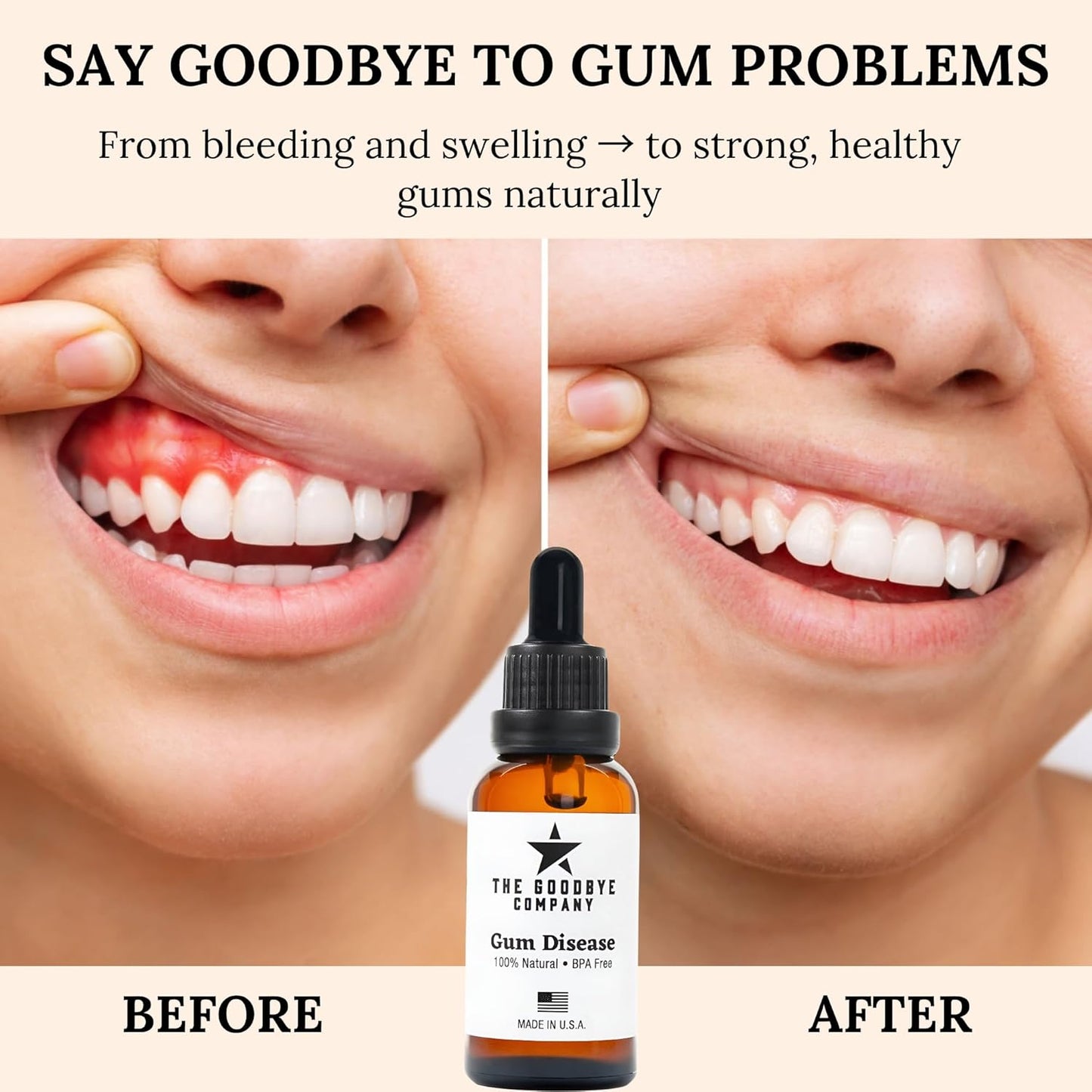 The Goodbye Company Gum Disease Treatment - 100% Pure Neem & Clove Oil - Natural Gingivitis Remedy - Non-Toxic, BPA-Free Oral Care - Fast-Acting Gum Healer (30ml)