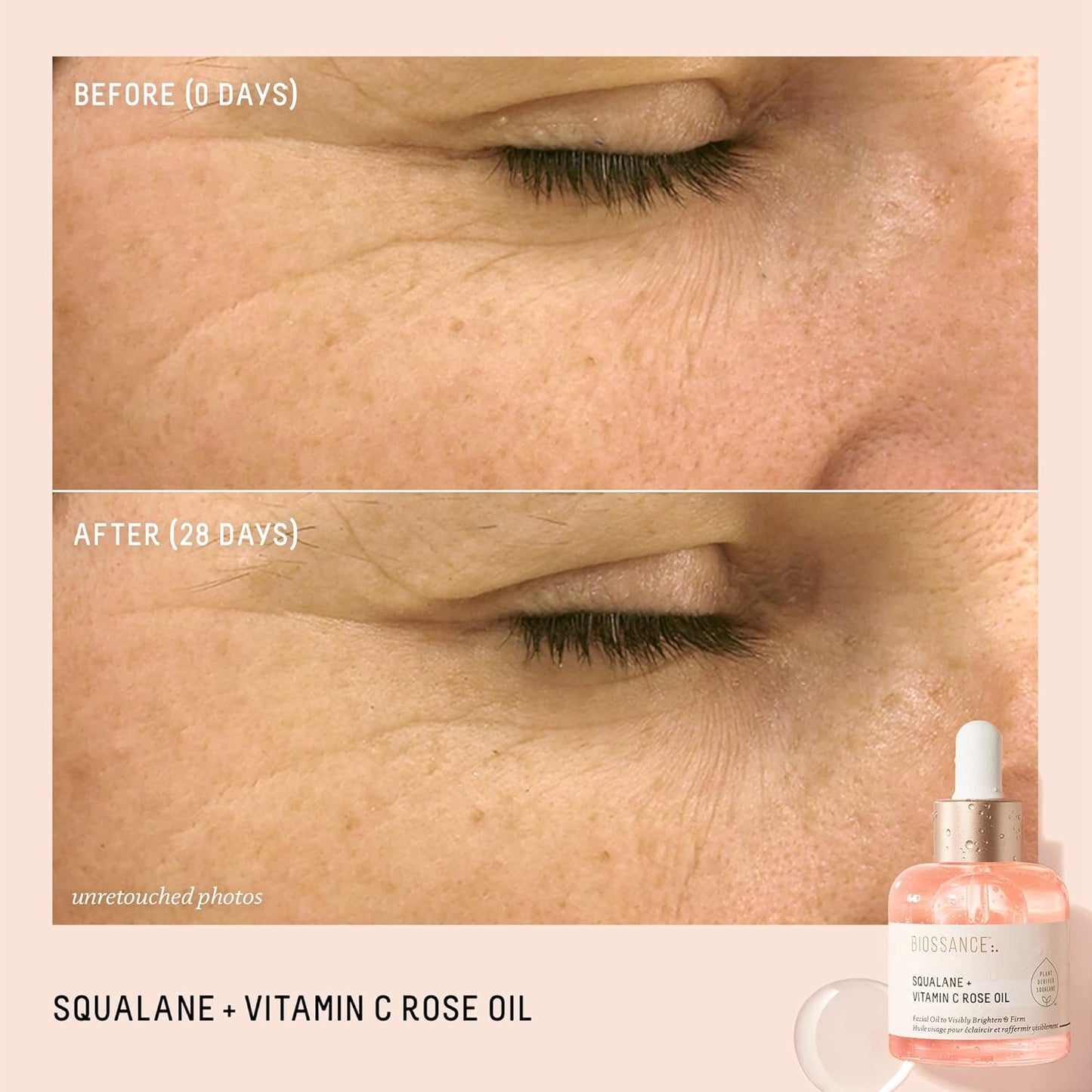 BIOSSANCE Squalane + Vitamin C Rose Advanced Facial Oil - Brightening, Firming, and Hydrating Serum for All Skin Types - Chios Crystal Oil, Damascus Rose Extract & Squalane for Radiance