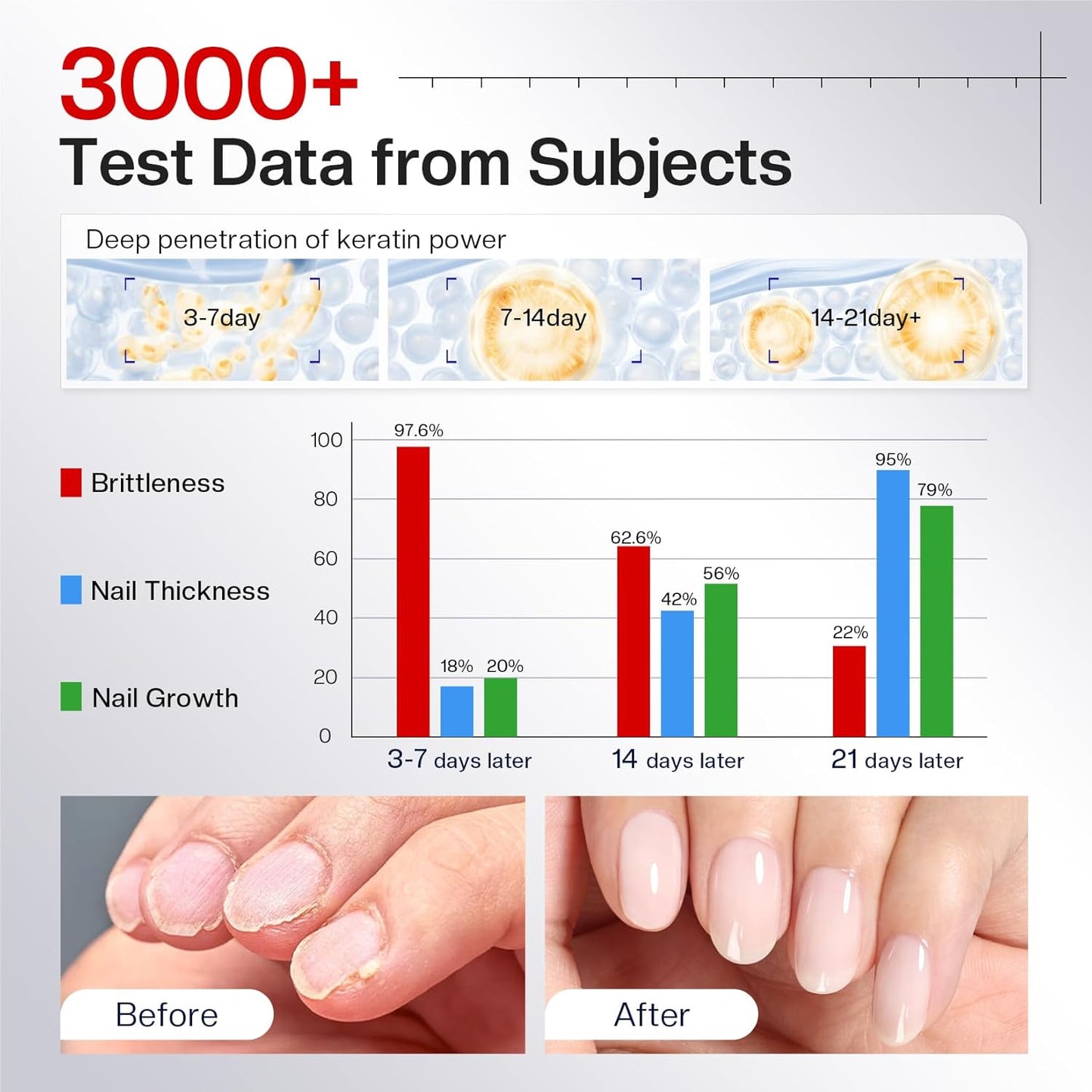 Morovan Nail Strengthener and Growth: Natural Keratin Repair Milky White Nail Polish Hardener & Ridge Filler Treatment for Damaged Nails, Nail Concealer and Essential Nail Care for women