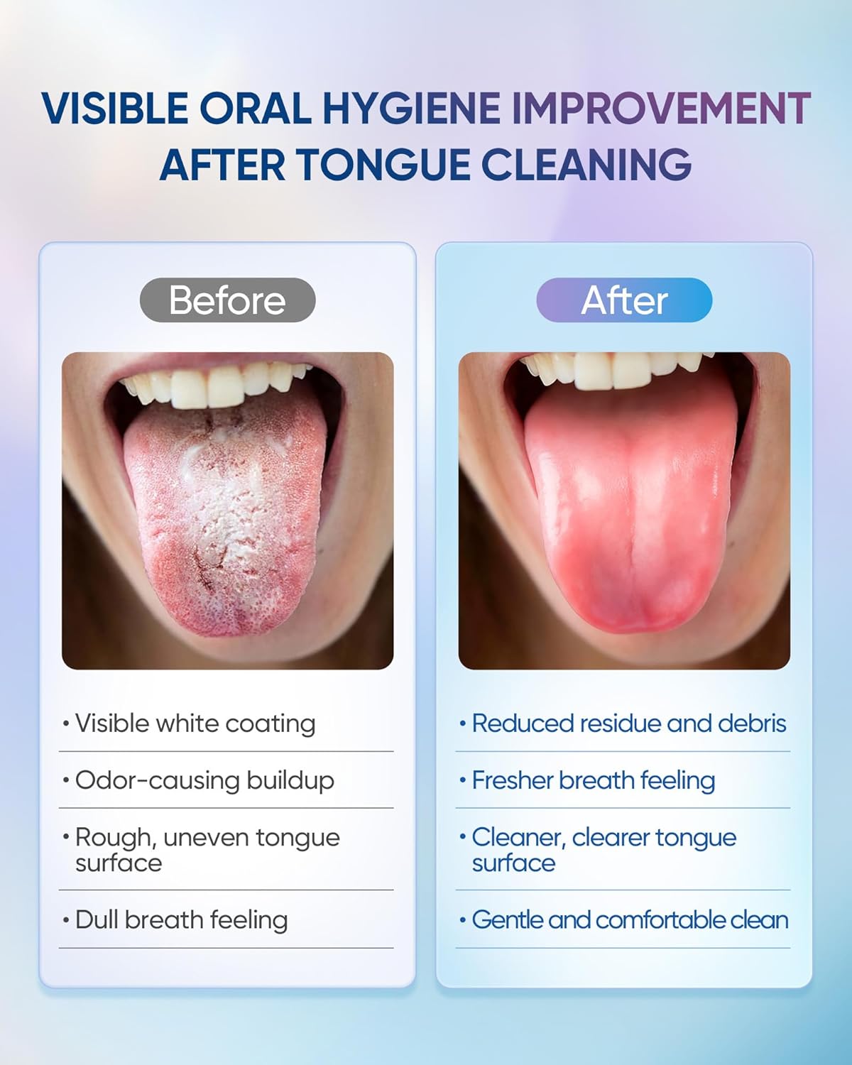 BodyAccel Tongue Cleaner Gel with Tongue Brush – Fresh Breath Oral Care Kit – Tongue Scraper Gel Set for Bad Breath Removal, Maintain Oral Health