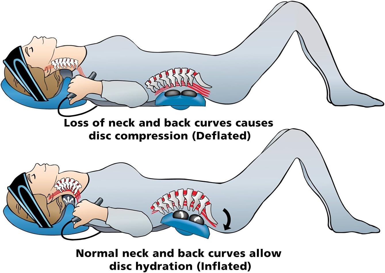 POSTURE PUMP Relief for Neck and Back Pain - Deluxe Full Spine Model 4100-S (Single Air Cell Cervical) DISC HYDRATOR
