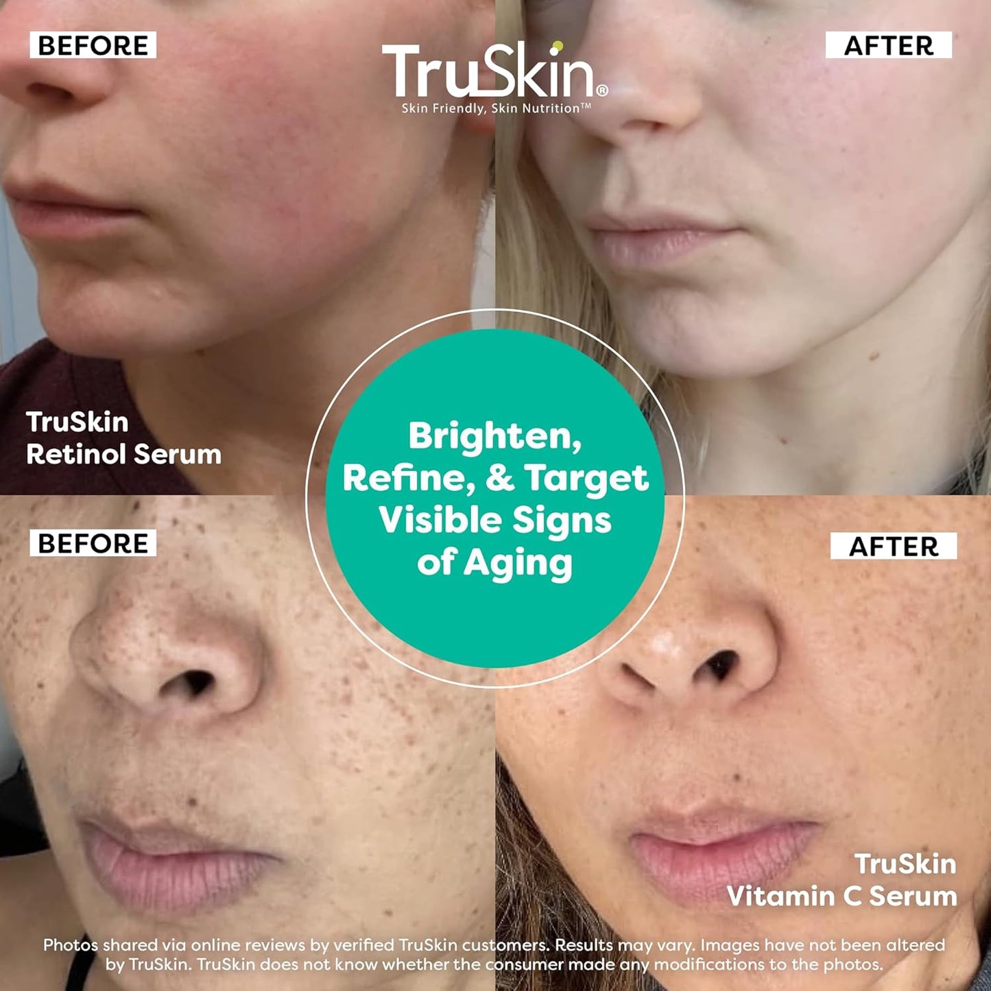 TruSkin Face Serum Duo – Vitamin C Serum & Retinol Serum for Face – AM & PM Anti Aging Skincare Routine – Brightening & Smoothing Facial Serums, 1 fl oz Each