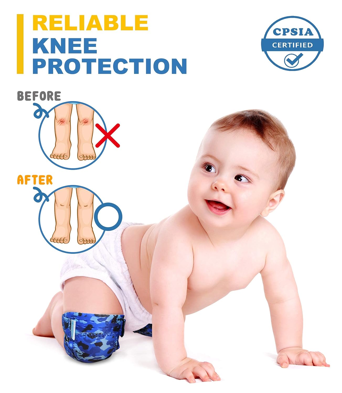 Simply Kids Baby Knee Pads for Crawling (2 Pairs) Rodilleras para Bebe, CPSIA Certified - Infant Knee Protector for Toddler, Girl, Boy, Crawler
