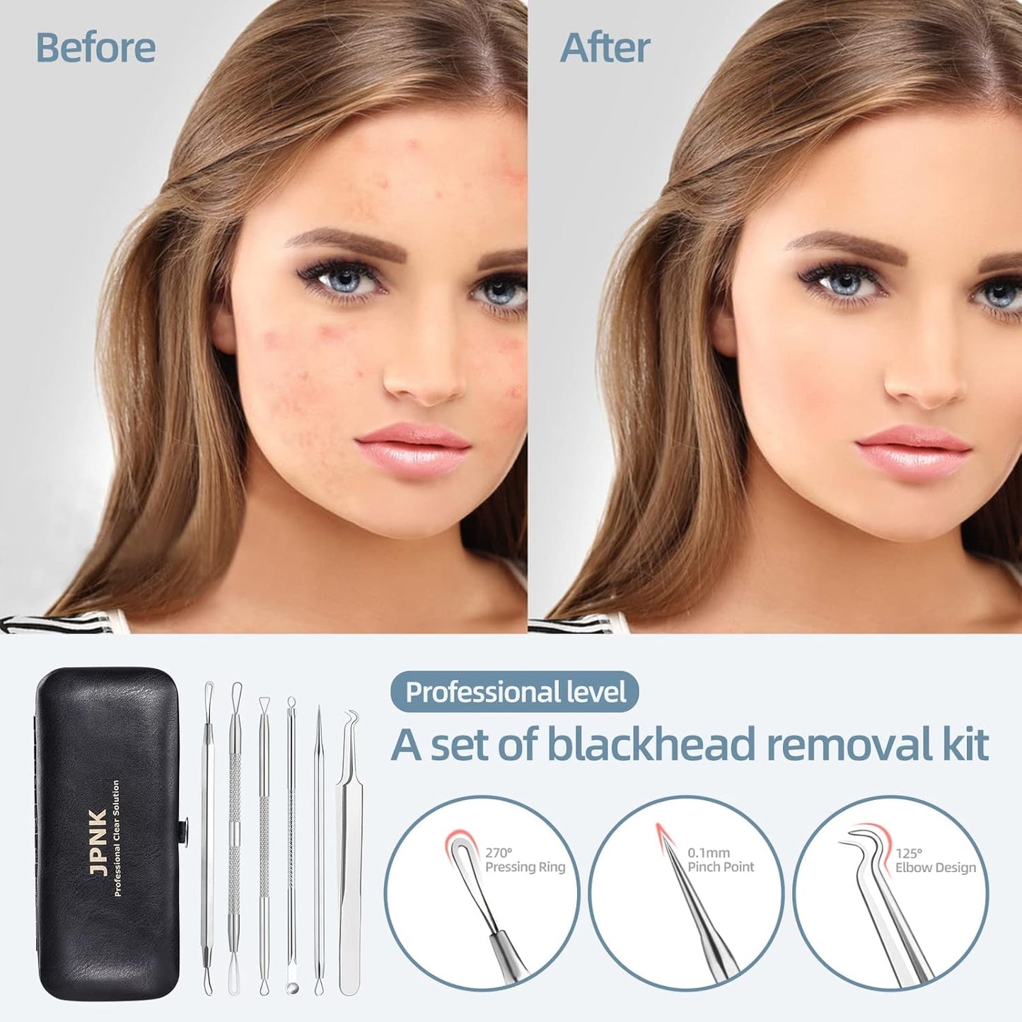 JPNK Blackhead Remover Comedone Extractor Acne Removal Kit..