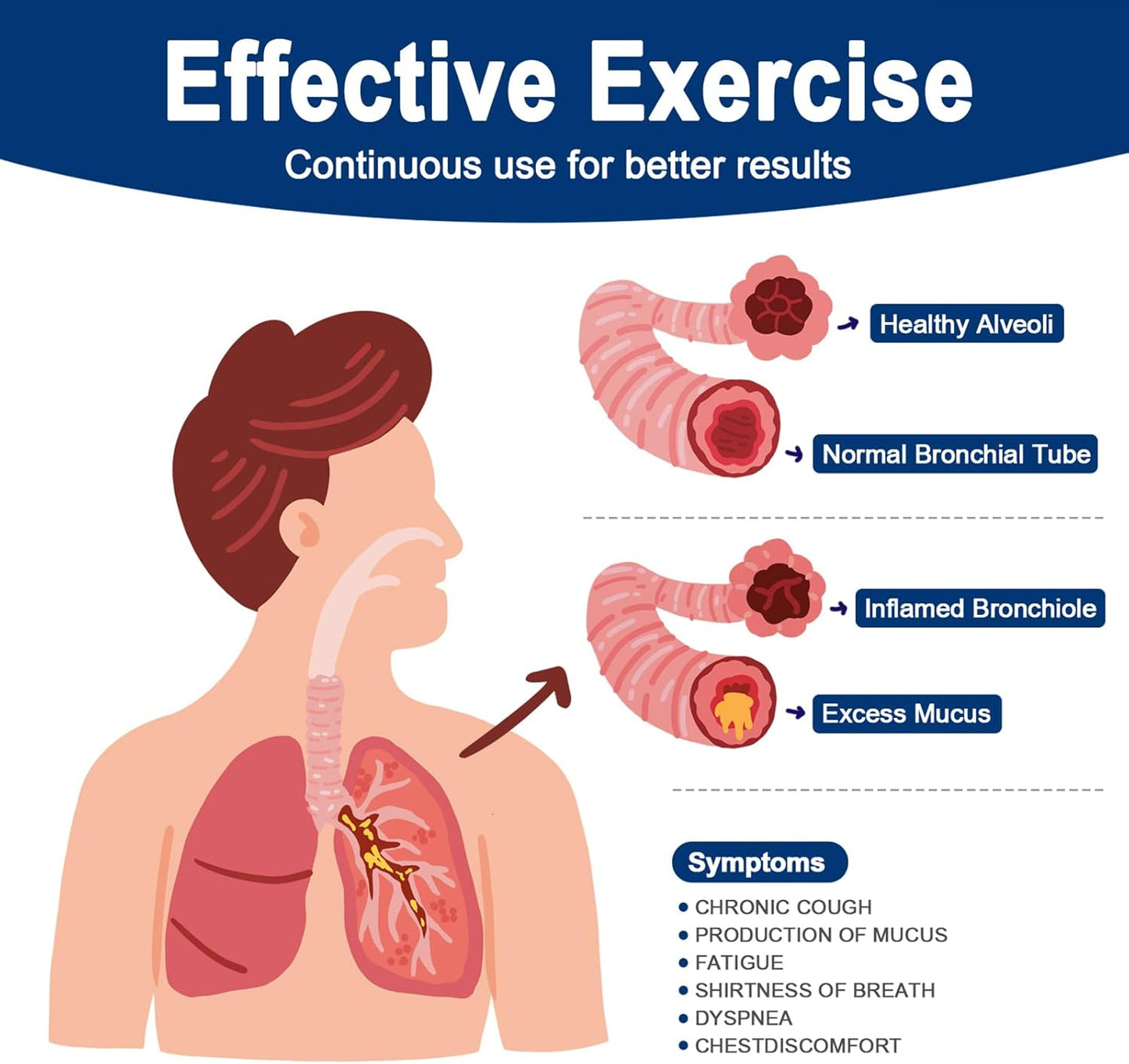 Flutter Valve, Breathing Exercise Device for Lungs, Adjustable Resistance Natural Mucus Clearance, Portable Lung Exerciser Device | Breathing Trainer
