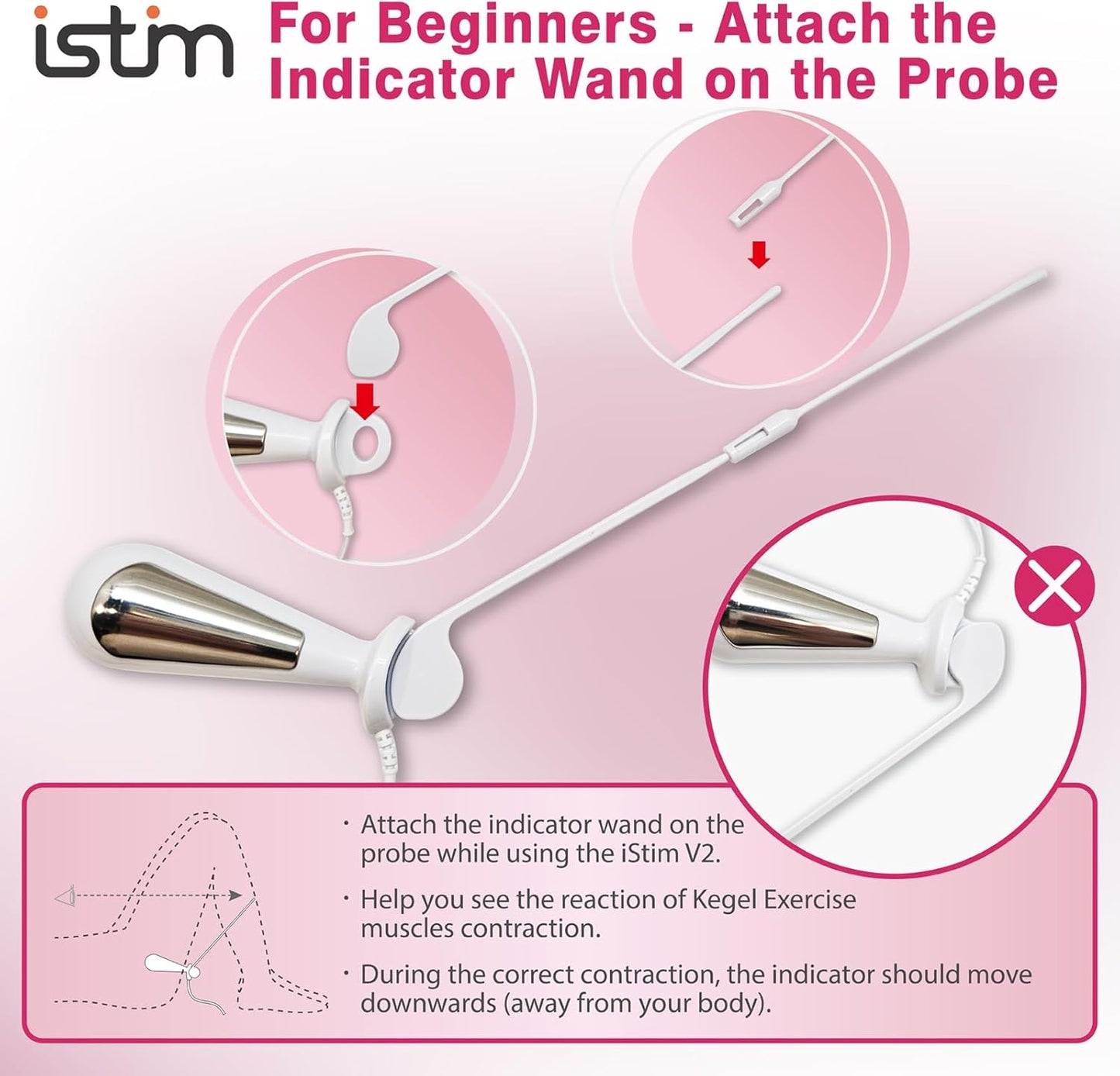 Everyway Incontinence Stimulation System - iStim V2 Kegel Trainer Incontinence Stimulator for Bladder Control & Pelvic Floor Muscle Therapy for Women