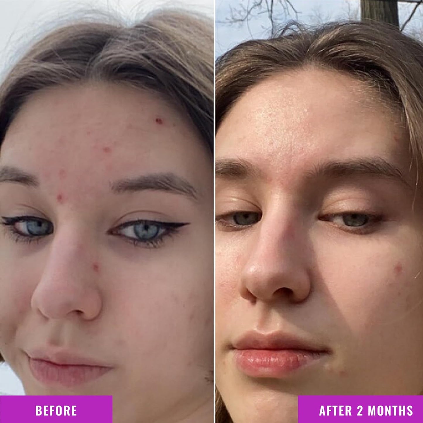 Good Molecules Niacinamide Serum - 10% Niacinamide to Target Blemishes, Nourishment, and Skin Tone - Ultra Hydrating Serum and Brightening Skin Care for Face