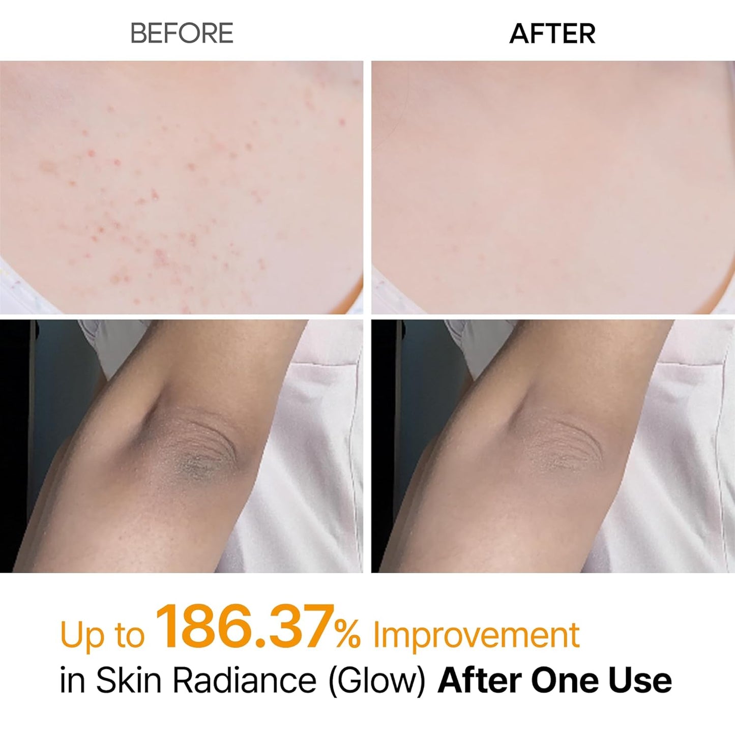 Dr.Melaxin Body Keratin Care Kojic Acid Turmeric Spray Gently Exfoliating Peeling Solution Korean Skincare All Skin Types 200ml