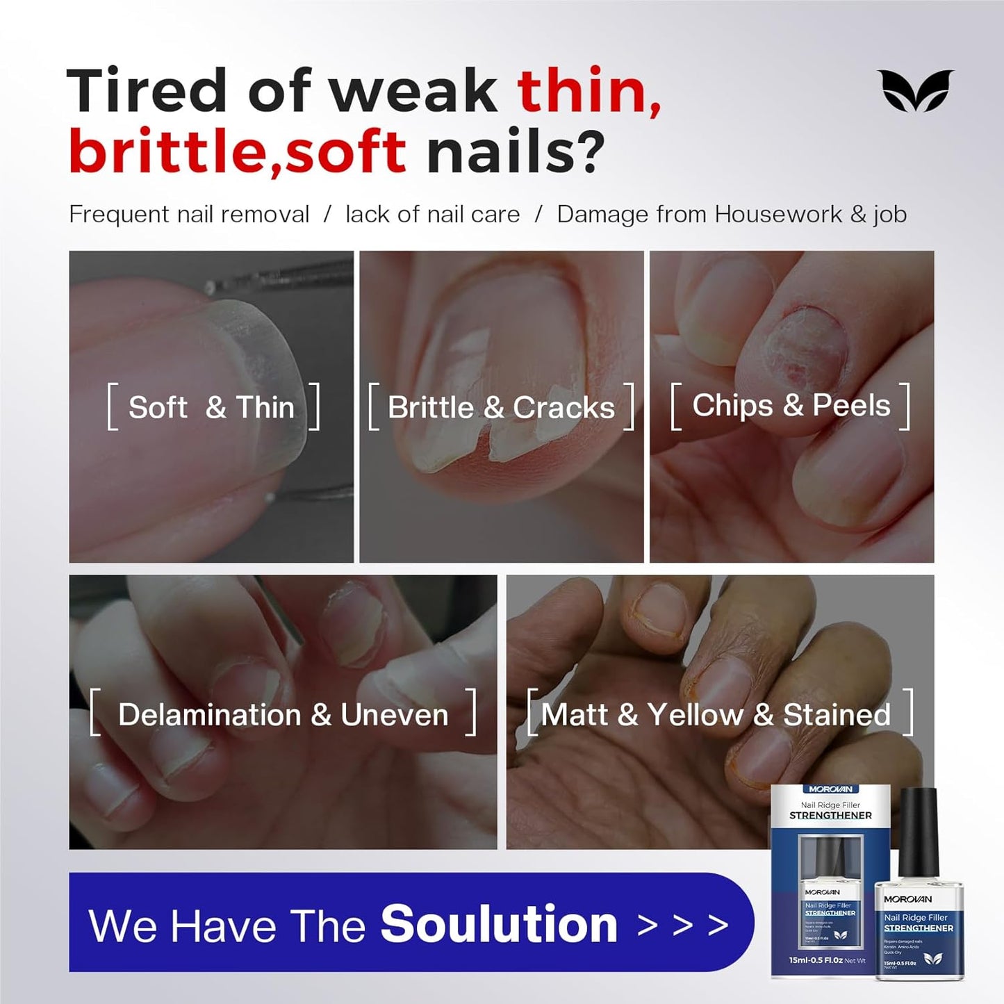 Morovan Nail Strengthener and Growth: Natural Keratin Repair Milky White Nail Polish Hardener & Ridge Filler Treatment for Damaged Nails, Nail Concealer and Essential Nail Care for women