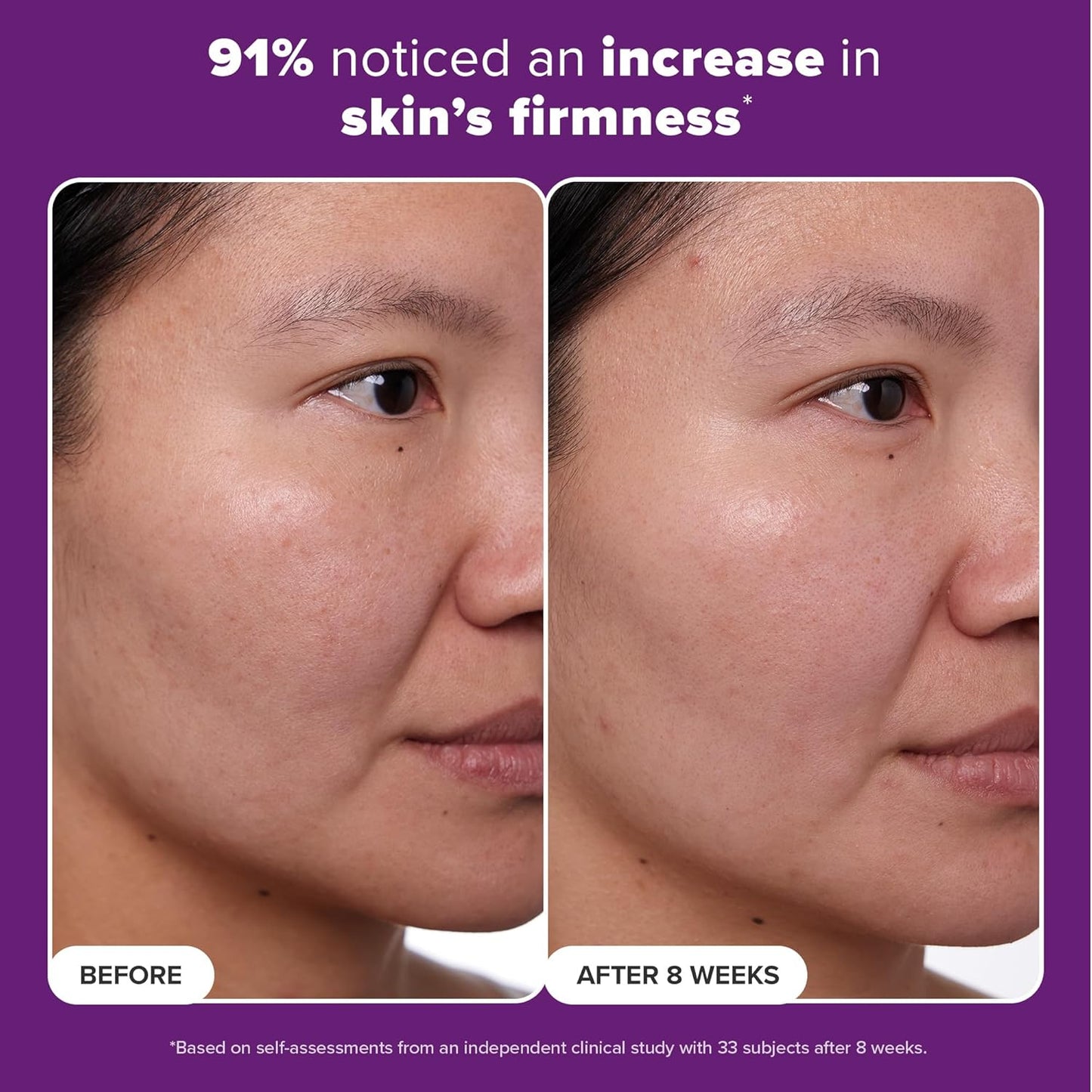 Paula's Choice CLINICAL 1% Retinol Face Treatment with Peptides, Vitamin C & Licorice Extract, Anti-Aging Skin Care Serum, Fine Lines & Wrinkles, Fragrance Free