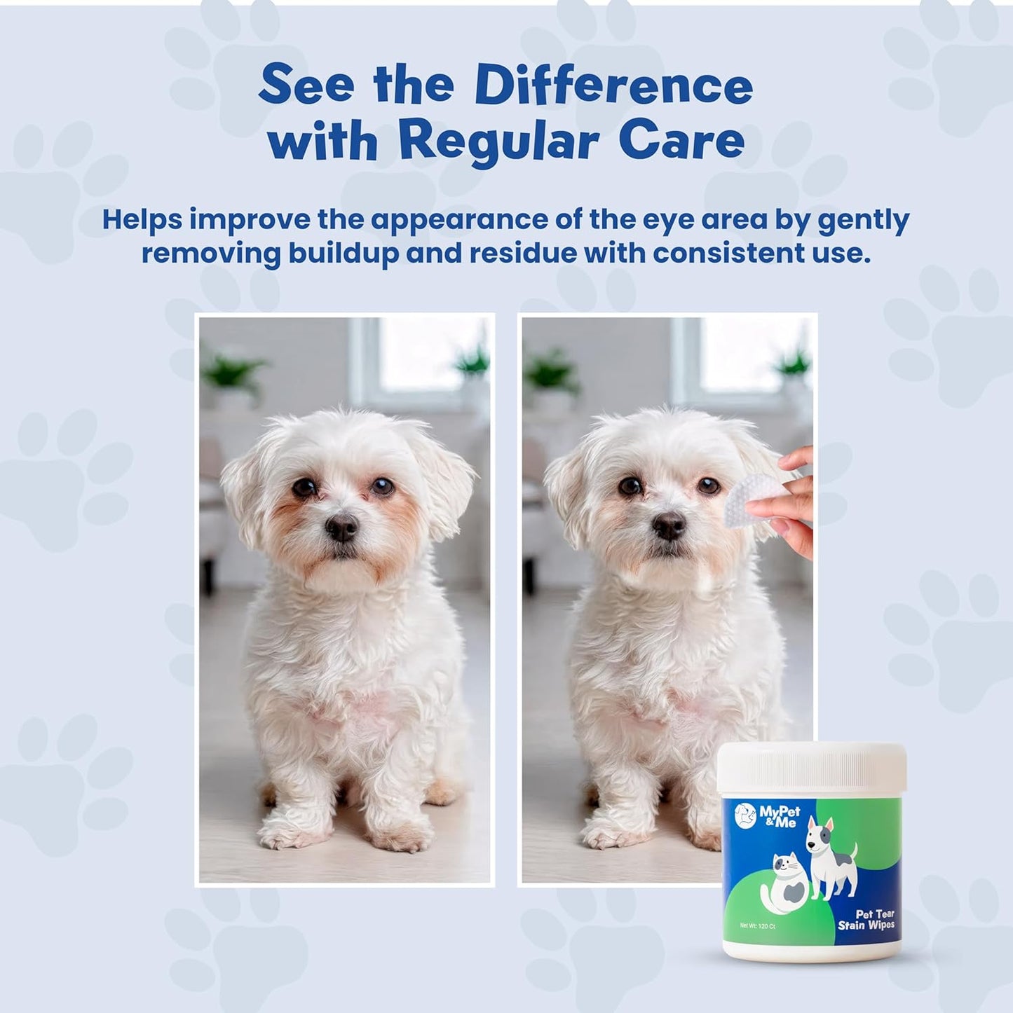 MyPet&Me Eye Wipes for Dogs, 120 Count – Tear Stain Remover & Fragrance-Free Dog Eye Wipes - Hypoallergenic Pet Eye Cleaning Wipes for Dirt & Discharge - Gentle Daily Eye Care for All Dogs and Cats