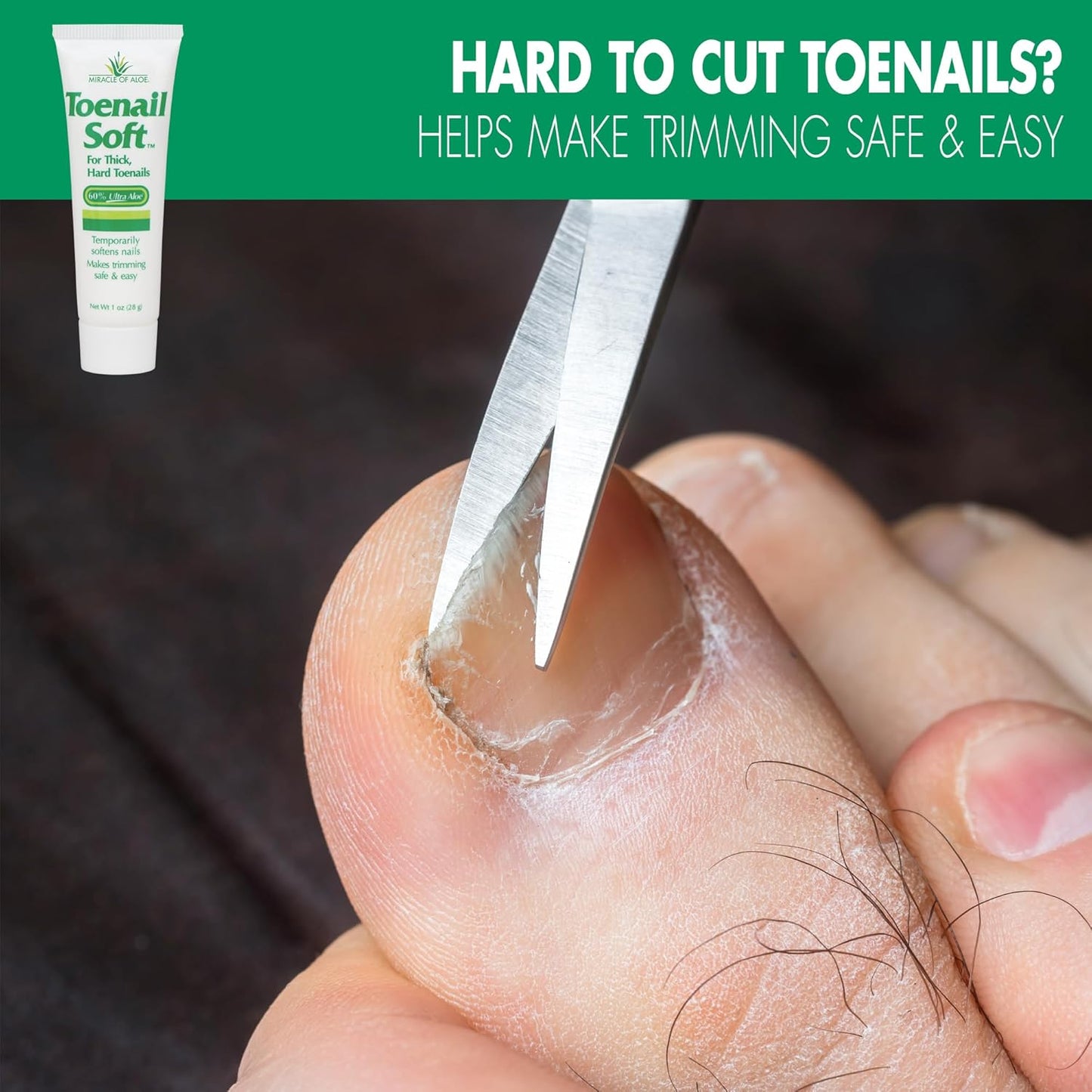 Toenail Softener for Thick Hard Toenails - Safe for Seniors & All Ages - Fast-Acting Toenail Softening Cream - Non Greasy Nail Cream Formulated with Natural Aloe Vera (1 Ounce Tube (Pack of 1))
