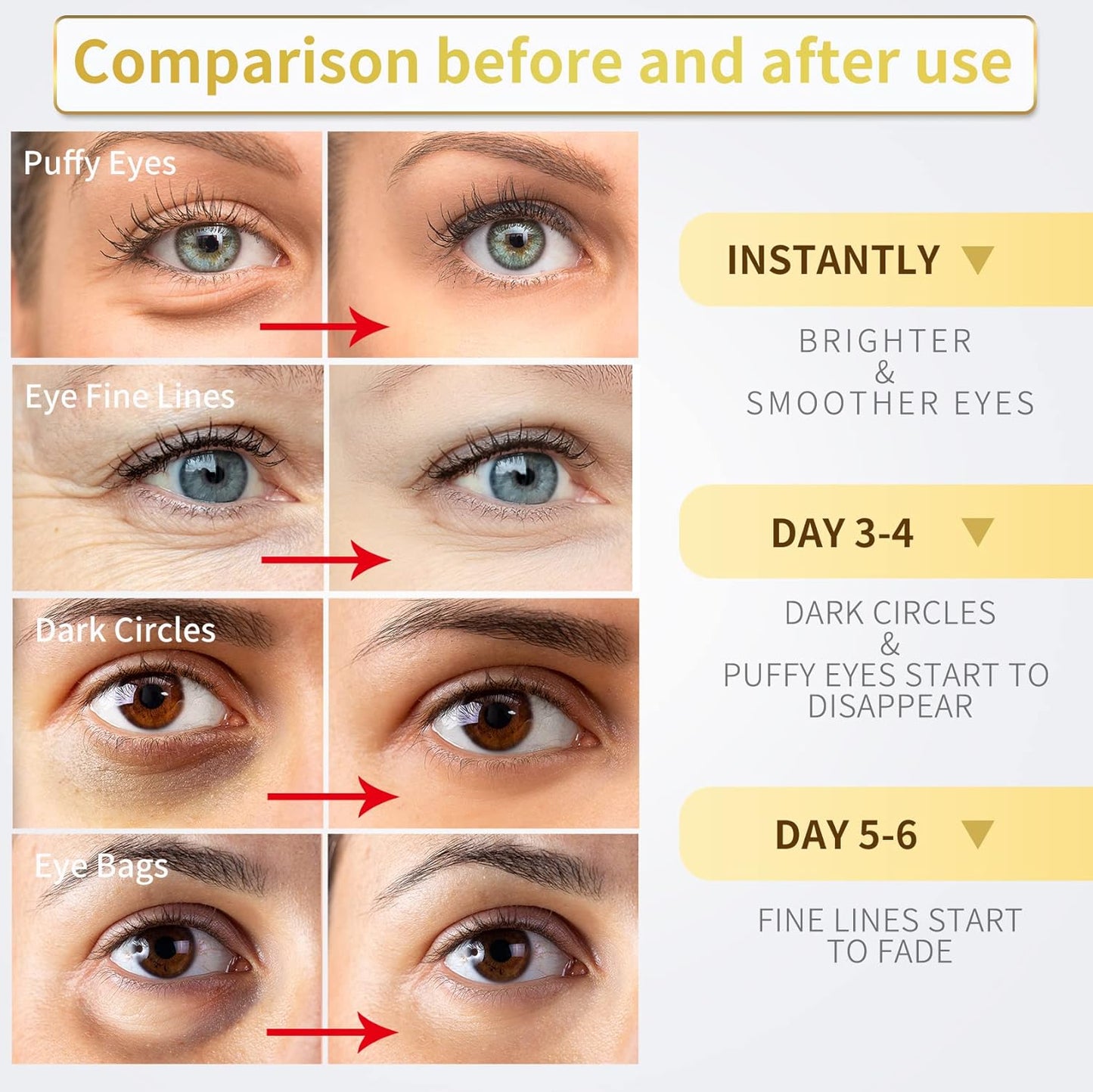 24K Gold Under Eye Patches - 60 Pack for Puffy Eyes, Dark Circles, Bags & Wrinkles with Collagen & Hyaluronic Acid - Eye Care Pads for Daily Skincare (Gold)