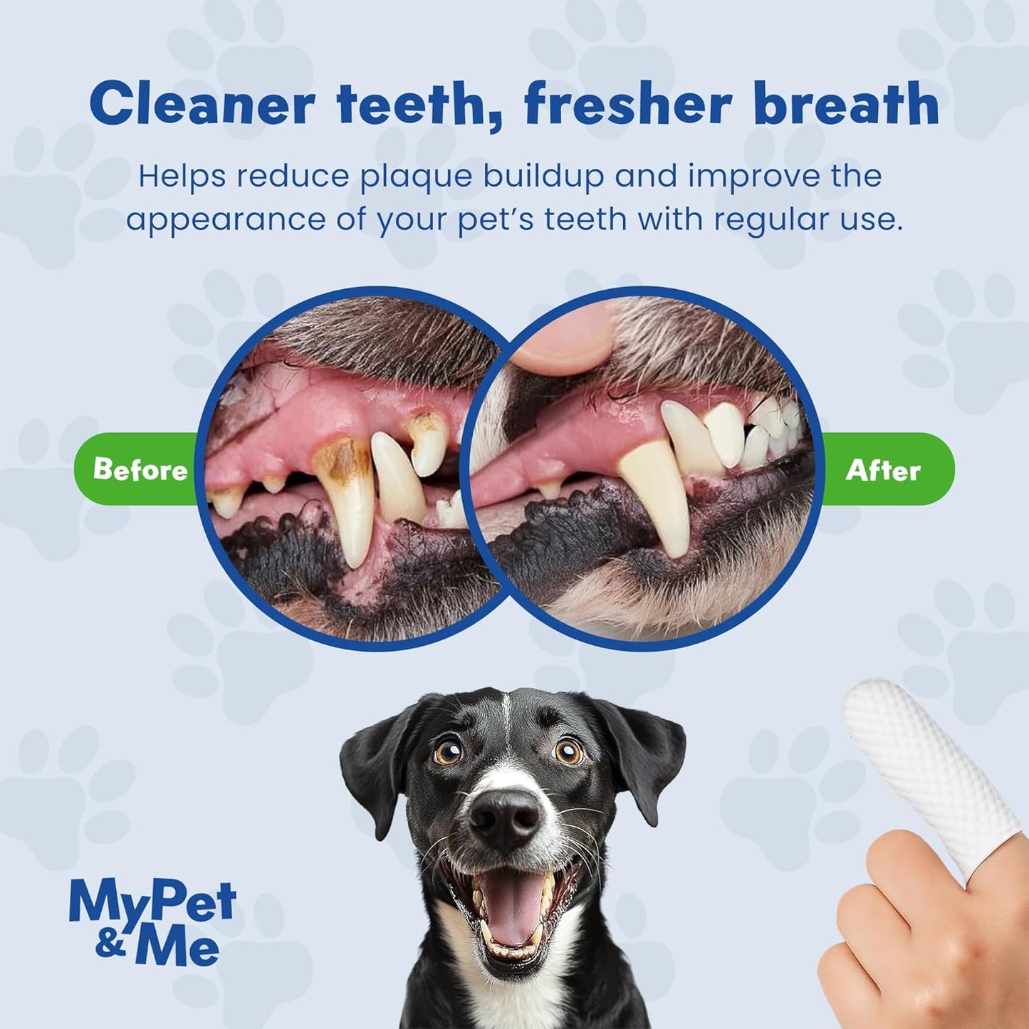 MyPet&Me Dog Dental Wipes, 50 Count - Disposable Finger Tooth Wipes for Dogs and Cats, Textured No-Rinse Cloths for Teeth and Gums, Fits Most Fingers, Travel-Friendly