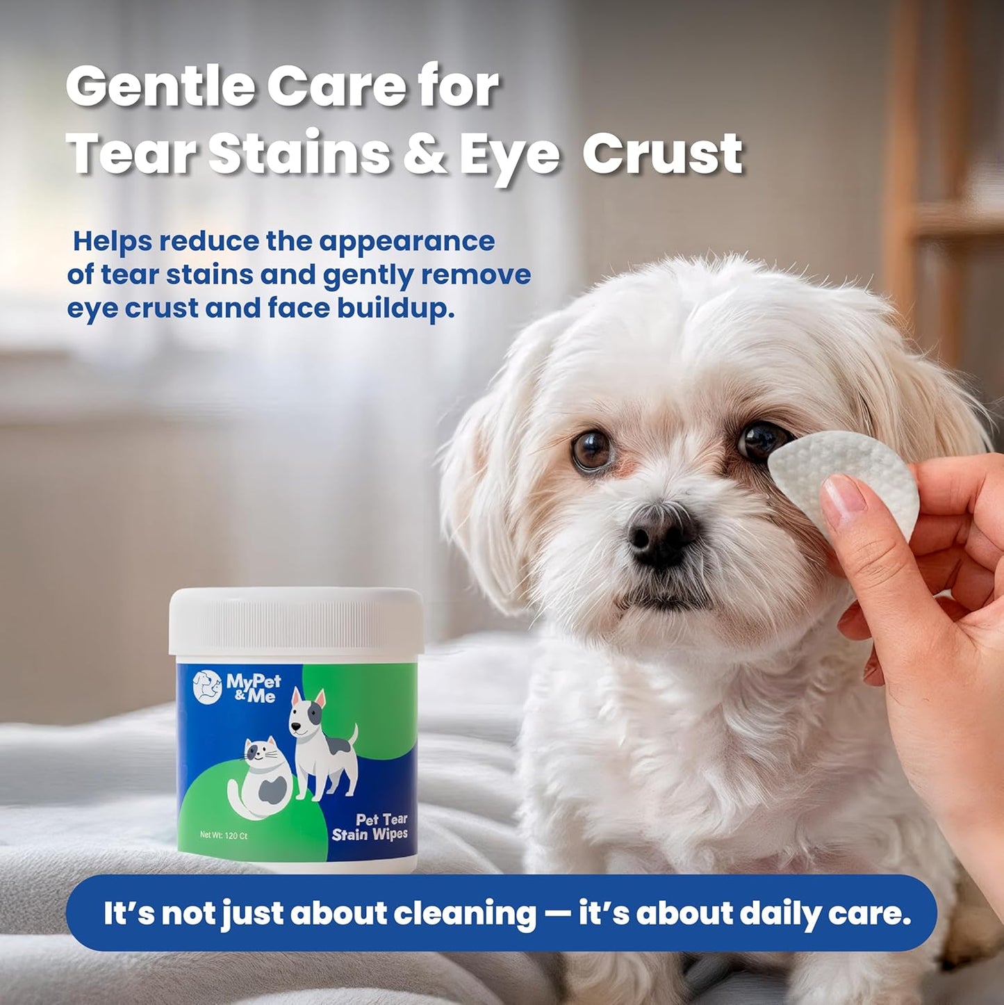 MyPet&Me Eye Wipes for Dogs, 120 Count – Tear Stain Remover & Fragrance-Free Dog Eye Wipes - Hypoallergenic Pet Eye Cleaning Wipes for Dirt & Discharge - Gentle Daily Eye Care for All Dogs and Cats