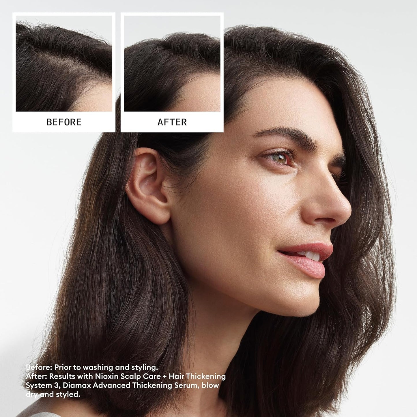 NIOXIN Scalp + Hair Thickening System Kits | For Natural, Colored, & Damaged Hair with Light to Progressed Thinning | Strengthen & Boost Hair Density with Niacinamide & Biotin | 1 Month Supply